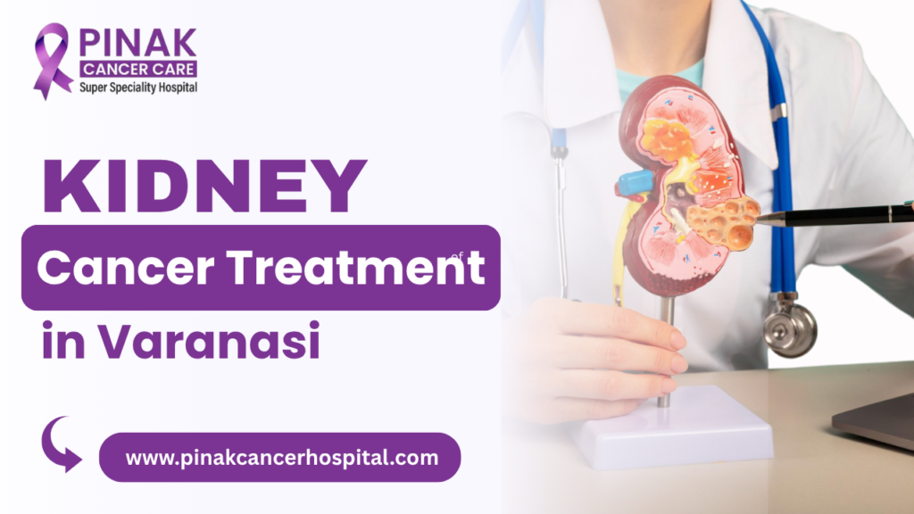 Kidney Cancer Treatment in Varanasi