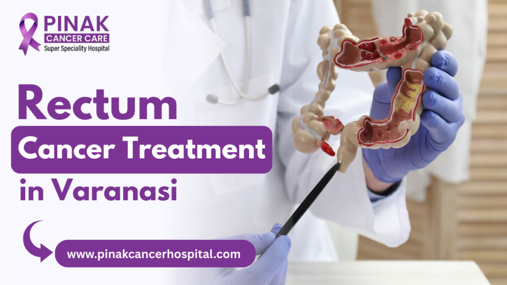 Rectum Cancer Treatment in Varanasi